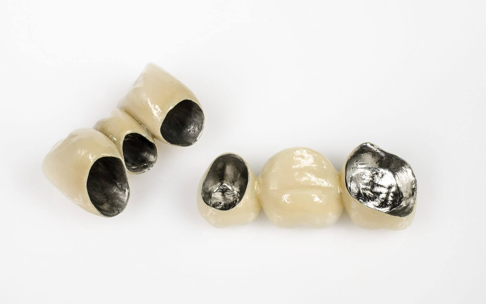 Dantų protezavimas metalo keramika