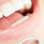 Dantų ligos: pagrindiniai dalykai, kuriuos turite žinoti apie dantų ligas ir jų gydymą